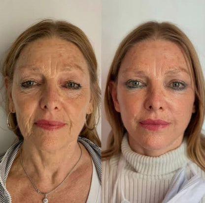 Balsamo viso rassodante - Elimina rughe e linee di espressione